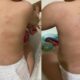mae-denuncia-creche-municipal-de-cuiaba-apos-ver-hematomas-em-bebe
