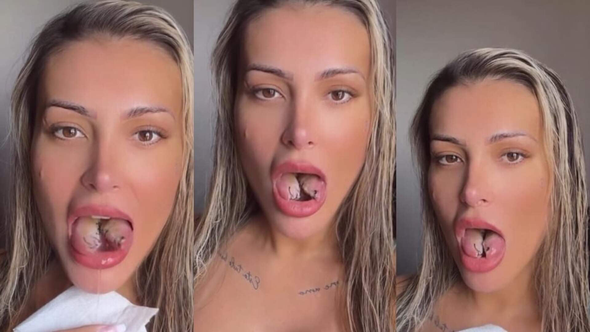 andressa-urach-faz-novas-atualizacoes-sobre-bifurcacao-na-lingua:-“bem-menos-dor”