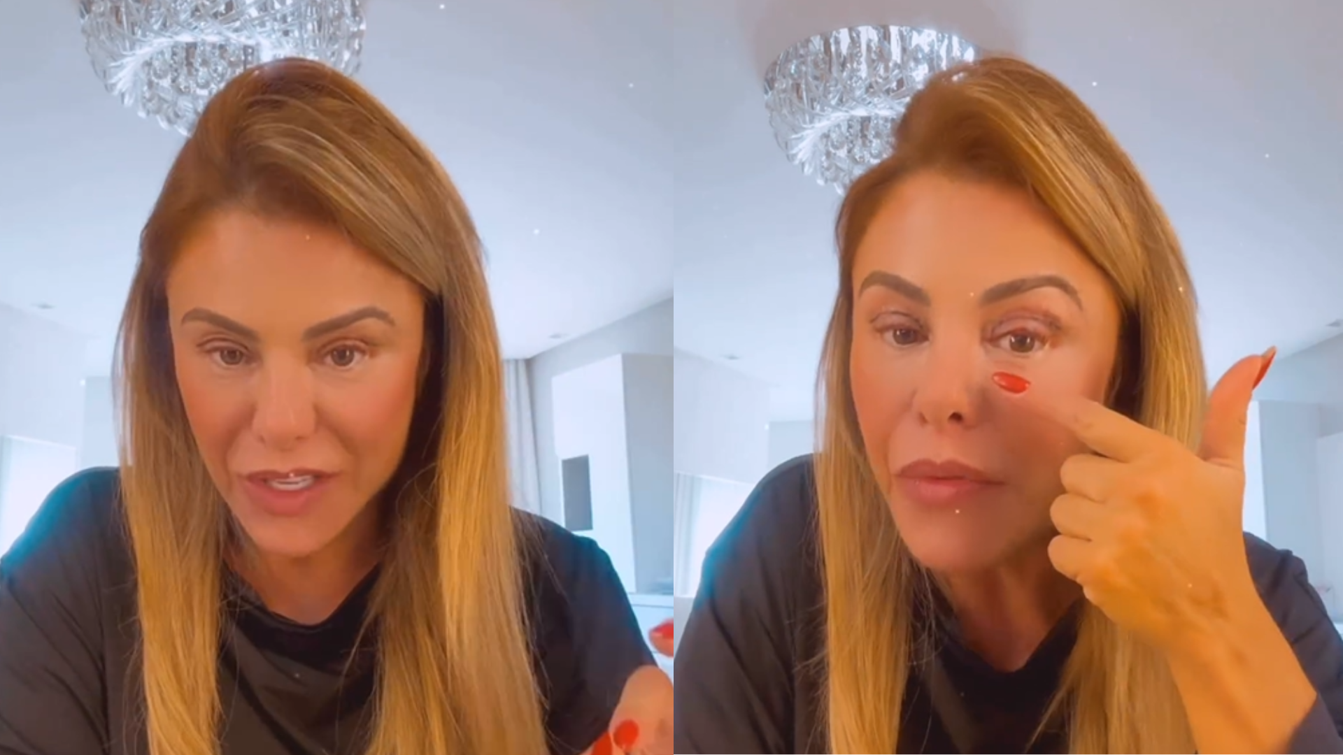 poliana-rocha-exibe-antes-e-depois-de-cirurgia-nas-palpebras