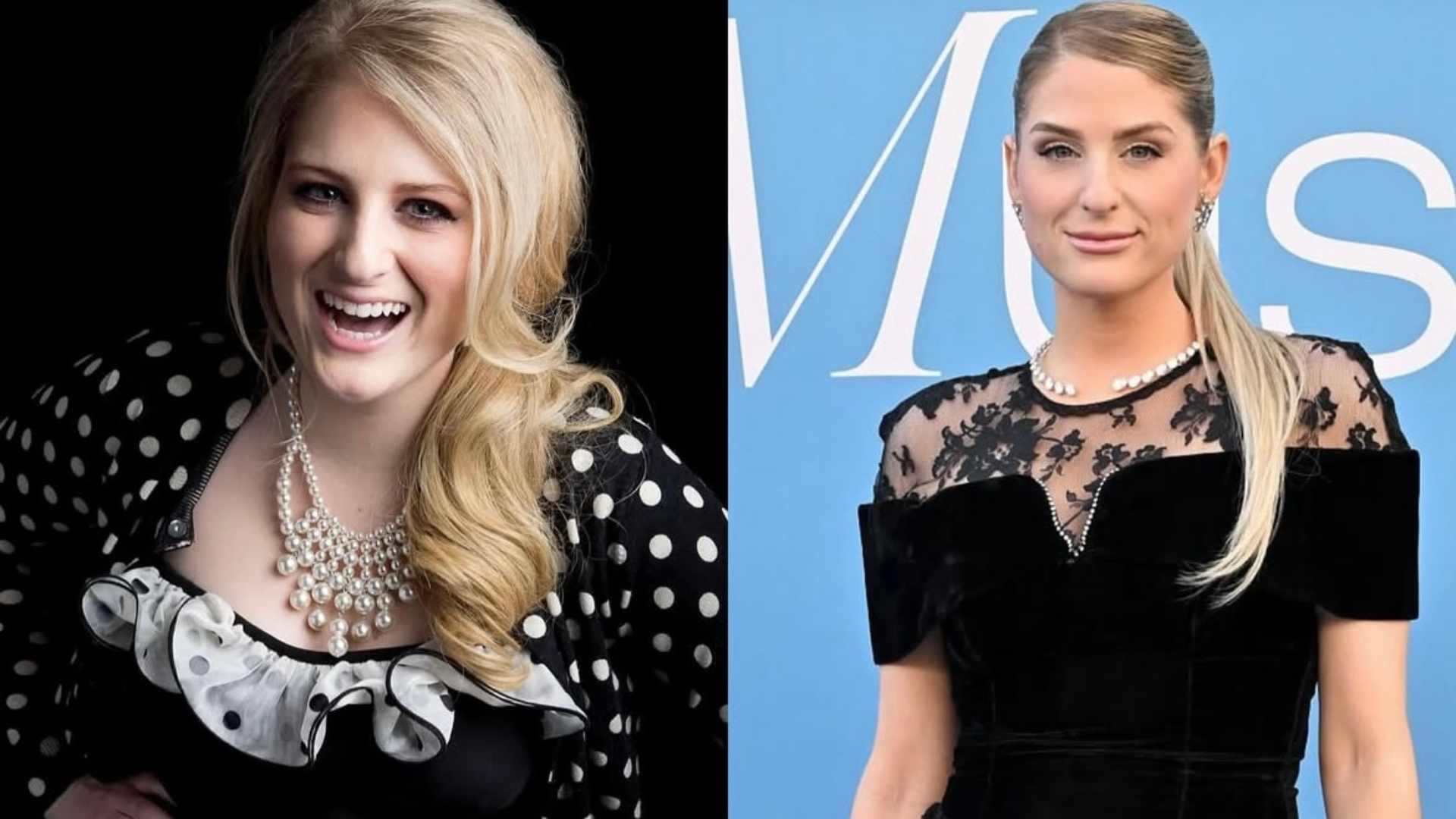 meghan-trainor-revela-uso-de-remedio-e-nova-rotina
